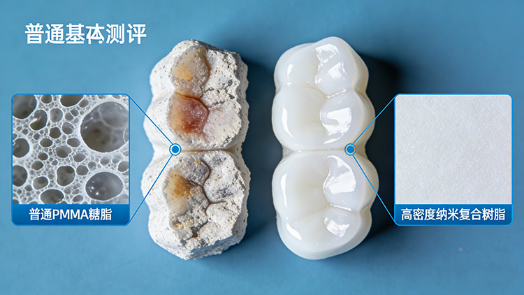 義齒發(fā)黃、松動(dòng)、有異味？成都義齒廠家解析三大問題根源與應(yīng)對(duì)方案
